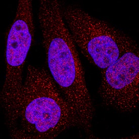 TORC3 antibody in HeLa Human Cell Line by Immunocytochemistry (ICC).