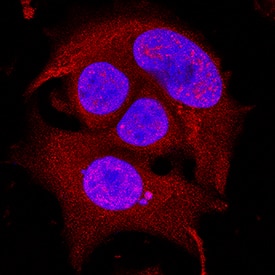 TOR antibody in MCF-7 Human Cell Line by Immunocytochemistry (ICC).