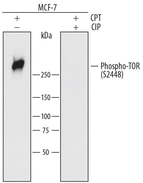 Detection of Human Phospho-TOR (S2448) antibody by Western Blot.