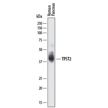 Detection of Human Tyrosylprotein Sulfotransferase 2/TPST2 antibody by Western Blot.