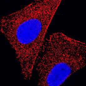 TPT1/TCTP antibody in HeLa Human Cell Line by Immunocytochemistry (ICC).