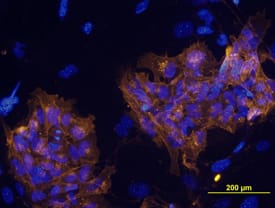 TRA-1-60 antibody in BG01V Human Stem Cells by Immunocytochemistry (ICC).