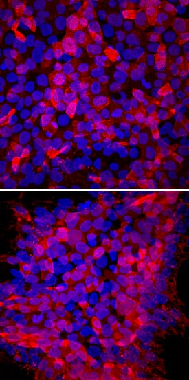 TRA-1-60(R) antibody in ADLF1 and FAB2 Stem Cell Lines by Immunocytochemistry (ICC).