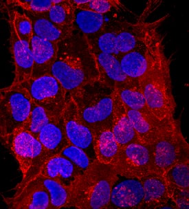 TRA-1-81 antibody in BG01V Human Embryonic Stem Cells by Immunocytochemistry (ICC).