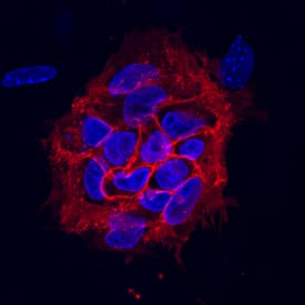 TRA-1-85/CD147 antibody in BG01V Human Embryonic Stem Cells by Immunocytochemistry (ICC).