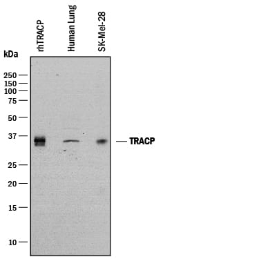 Detection of Human TRACP/PAP/ACP5 antibody by Western Blot.