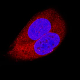 TRADD antibody in MCF-7 Human Cell Line by Immunocytochemistry (ICC).