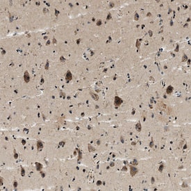 TRAIL R1/TNFRSF10A antibody in Human Brain by Immunohistochemistry (IHC-P).