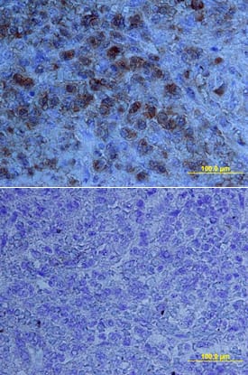 TRAIL R3/TNFRSF10C antibody in Human Spleen by Immunohistochemistry (IHC-P).