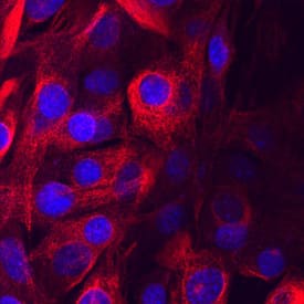 TRAM/TICAM2 antibody in C2C12 Mouse Cell Line by Immunocytochemistry (ICC).