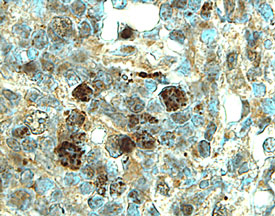 TRANCE/TNFSF11/RANK L antibody in Human Lymph Node by Immunohistochemistry (IHC-P).