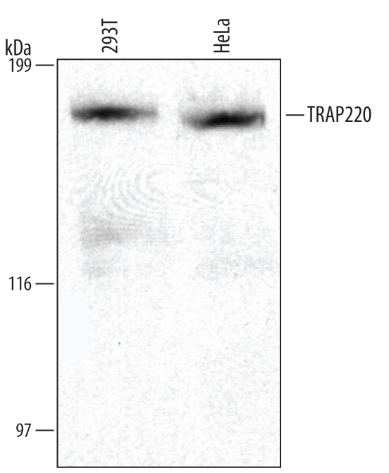 Detection of Human TRAP220 antibody by Western Blot.