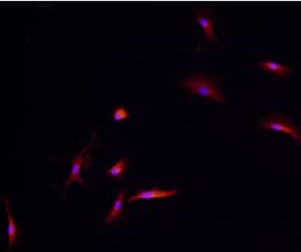 TREM2 antibody in Human Dendritic Cells by Immunocytochemistry (ICC).