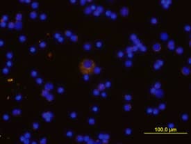 TREM-2 antibody in Mouse Splenocytes by Immunocytochemistry (ICC).