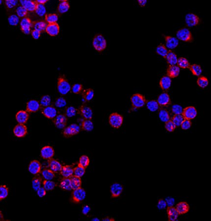 TREM2 antibody in RAW 264 by Immunocytochemistry (ICC).7 Mouse Cell Line by Immunocytochemistry (ICC).