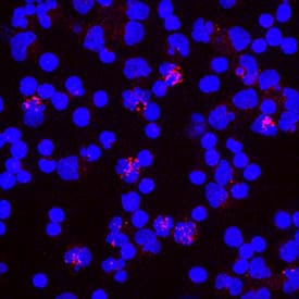 TREM2 antibody in Human PBMCs by Immunocytochemistry (ICC).