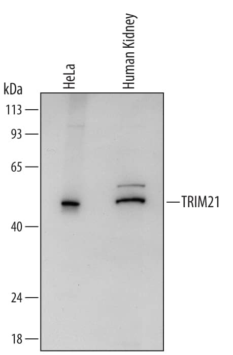 Detection of Human TRIM21 antibody by Western Blot.