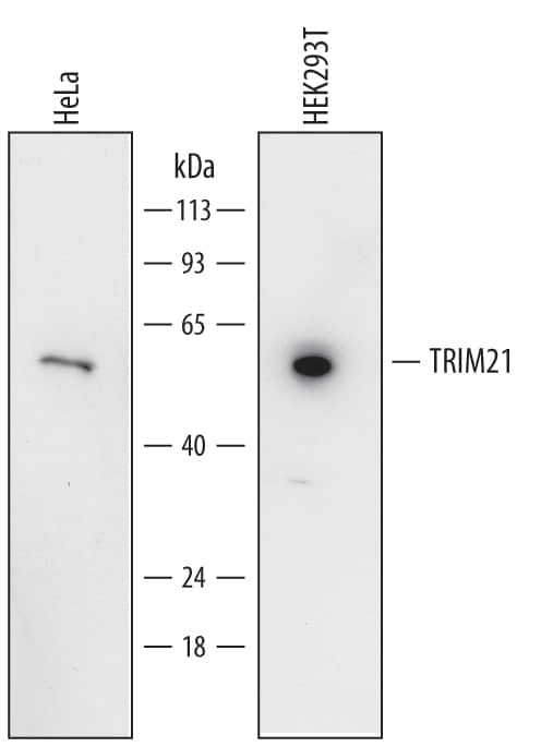 Detection of Human TRIM21 antibody by Western Blot.