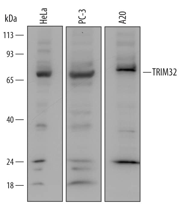 Detection of Human and Mouse TRIM32 antibody by Western Blot.