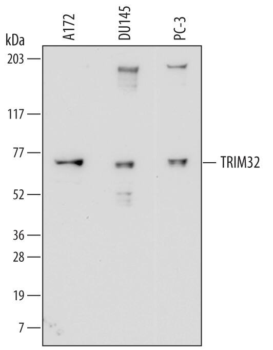 Detection of Human TRIM32 antibody by Western Blot.