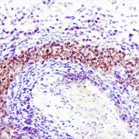TRIM38 antibody in Human Lymph Node by Immunohistochemistry (IHC-P).
