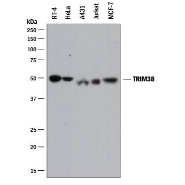 Detection of Human TRIM38 antibody by Western Blot.