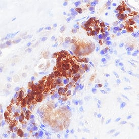 TRIM38 antibody in Human Lymph Node by Immunohistochemistry (IHC-P).