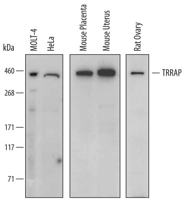 Detection of Human, Mouse, and Rat TRRAP antibody by Western Blot.