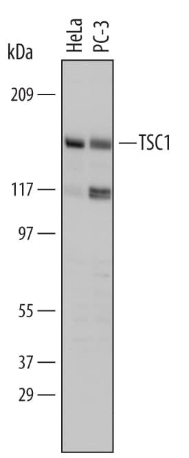 Detection of Human TSC1 antibody by Western Blot.