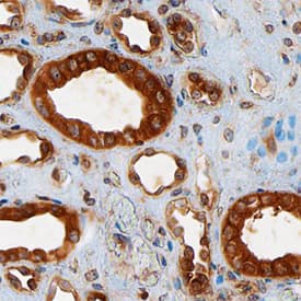 TSC2 antibody in Human Kidney by Immunohistochemistry (IHC-P).