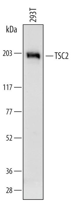 Detection of Human TSC2 by Western Blot. Detection of Human TSC2 antibody by Western Blot.