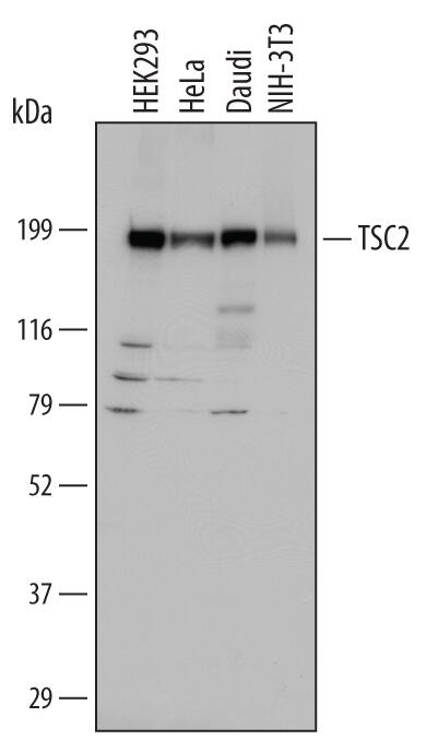 Detection of Human and Mouse TSC2 by Western Blot. Detection of Human and Mouse TSC2 antibody by Western Blot.