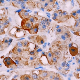 TSH  beta antibody in Human Pituitary by Immunohistochemistry (IHC-P).