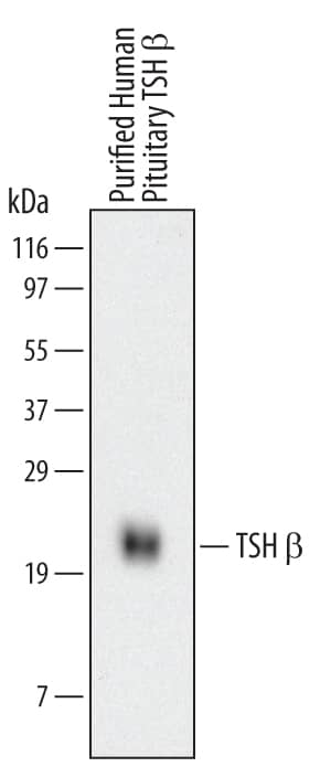 Detection of Human TSH  beta antibody by Western Blot.