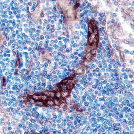 TSLP R antibody in Human Lymph Node by Immunohistochemistry (IHC-P).