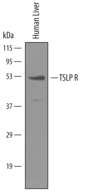 Detection of Human TSLP R antibody by Western Blot.