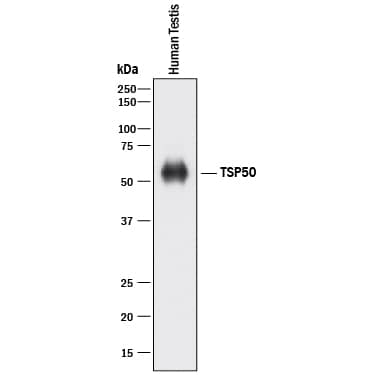 Detection of Human TSP50 antibody by Western Blot.