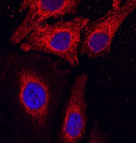 TSPAN12 antibody in HeLa Human Cell Line by Immunocytochemistry (ICC).