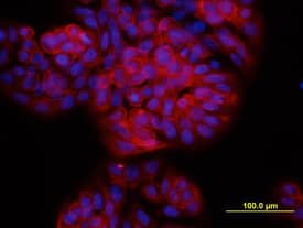 TSPAN8 antibody in HT-29 Human Cell Line by Immunocytochemistry (ICC).