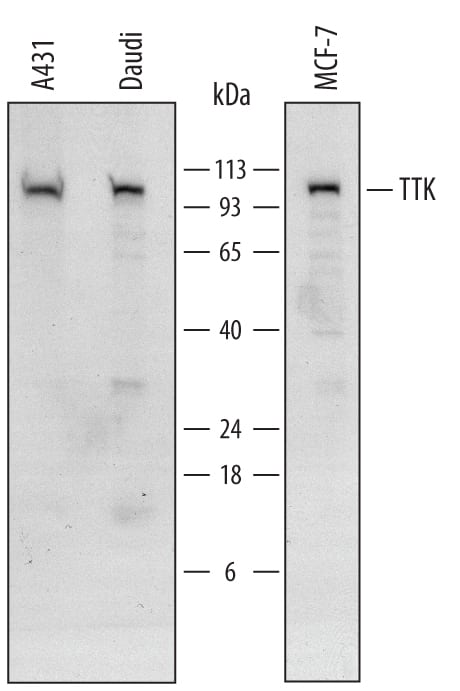 Detection of Human TTK antibody by Western Blot.