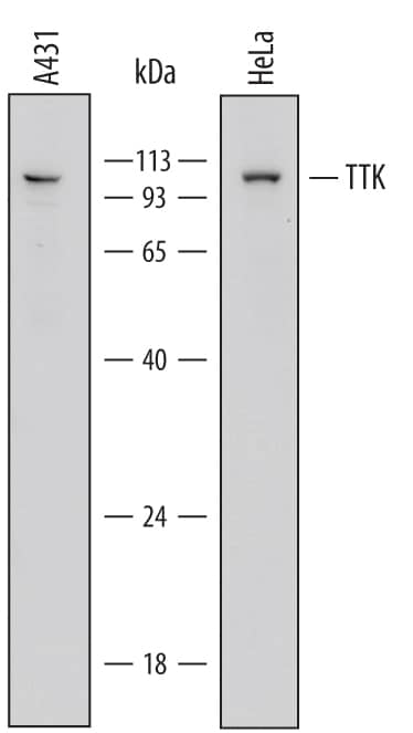 Detection of Human TTK antibody by Western Blot.