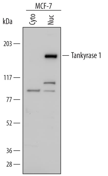 Detection of Human Tankyrase 1 antibody by Western Blot.