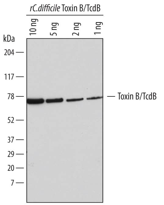 Detection ofC. difficileToxin B/TcdB antibody by Western Blot.