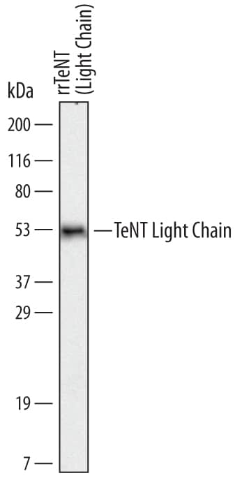 Detection ofC. tetaniTeNT Light Chain antibody by Western Blot.