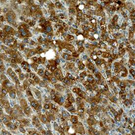 Tec antibody in Human Liver by Immunohistochemistry (IHC-P).