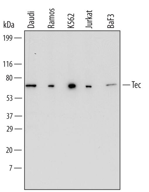 Detection of Human and Mouse Tec antibody by Western Blot.