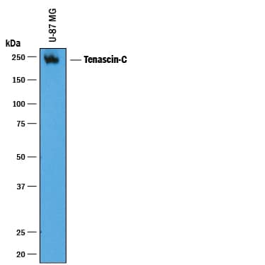 Detection of Human Tenascin C antibody by Western Blot.