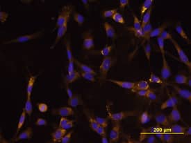 Tenascin C antibody in U-118 MG Human Cell Line by Immunocytochemistry (ICC).