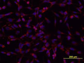 Tenascin C antibody in U-118-MG Human Cell Line by Immunocytochemistry (ICC).