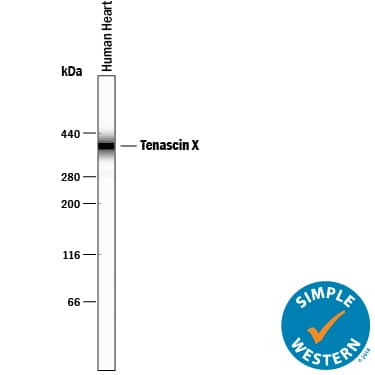 Detection of Human Tenascin X antibody by Simple WesternTM.